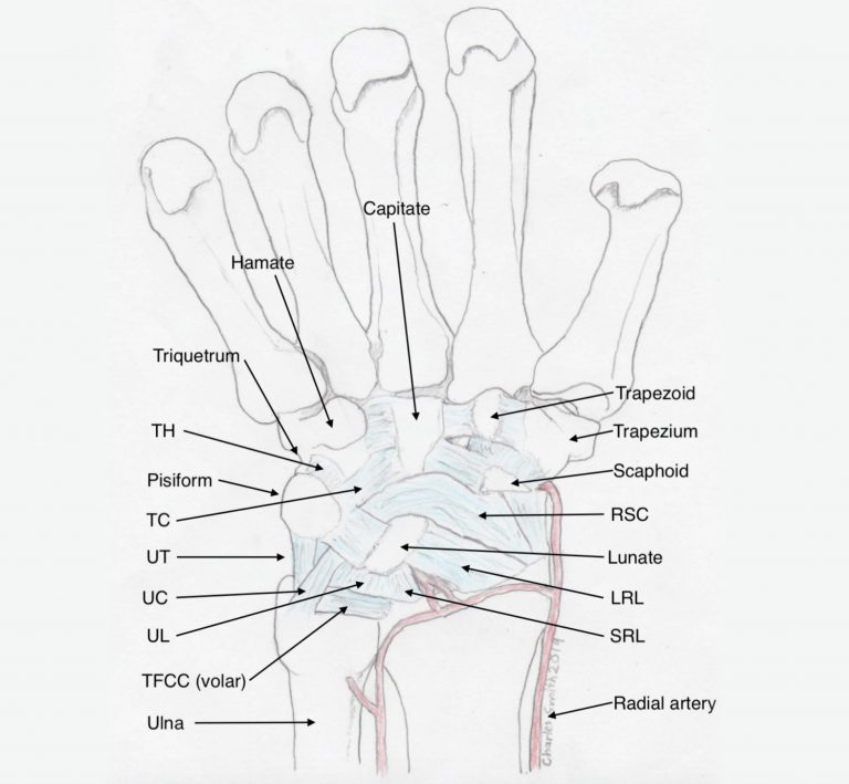 TFCC tears / DRUJ instability - Dr Nicholas Smith
